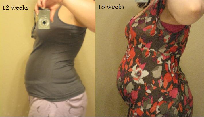 18 weeks pregnant. 18 weeks pregnant. and 18