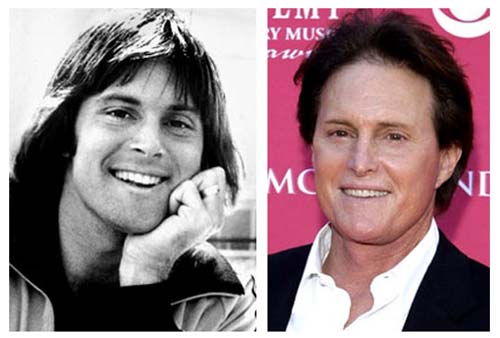 Plastic Surgery Before After: Bruce Jenner Plastic Surgery
