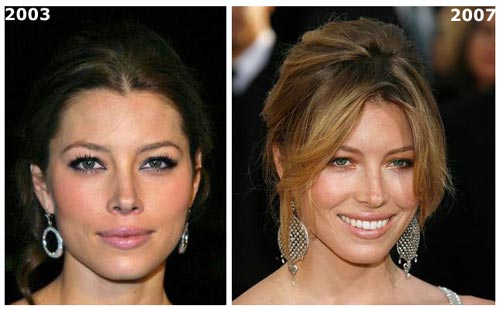 [Jessica-Biel-Nose-Job.jpg]