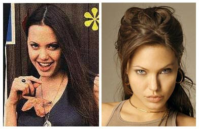 Angelina Jolie Plastic Surgery Before And After