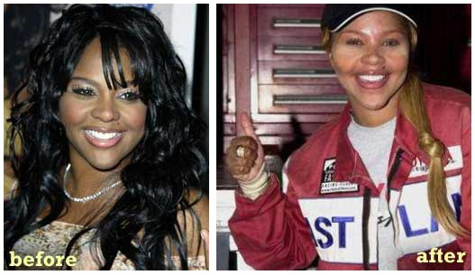before and after lil kim. Lil Kim Before And After Plastic Surgery