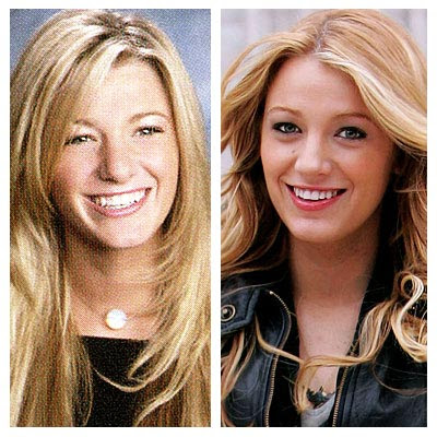 Blake Lively Nose Job. She said “she is weird” but even she looks gorgeous, 