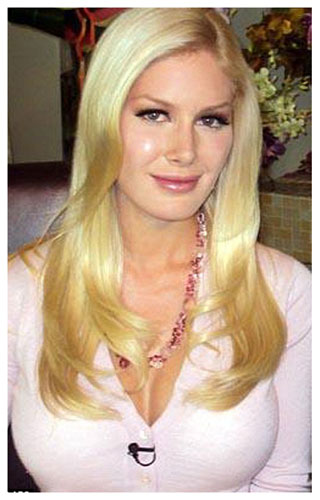 Heidi+montag+plastic+ heidi montag plastic surgery face. Heidi+montag+plastic+