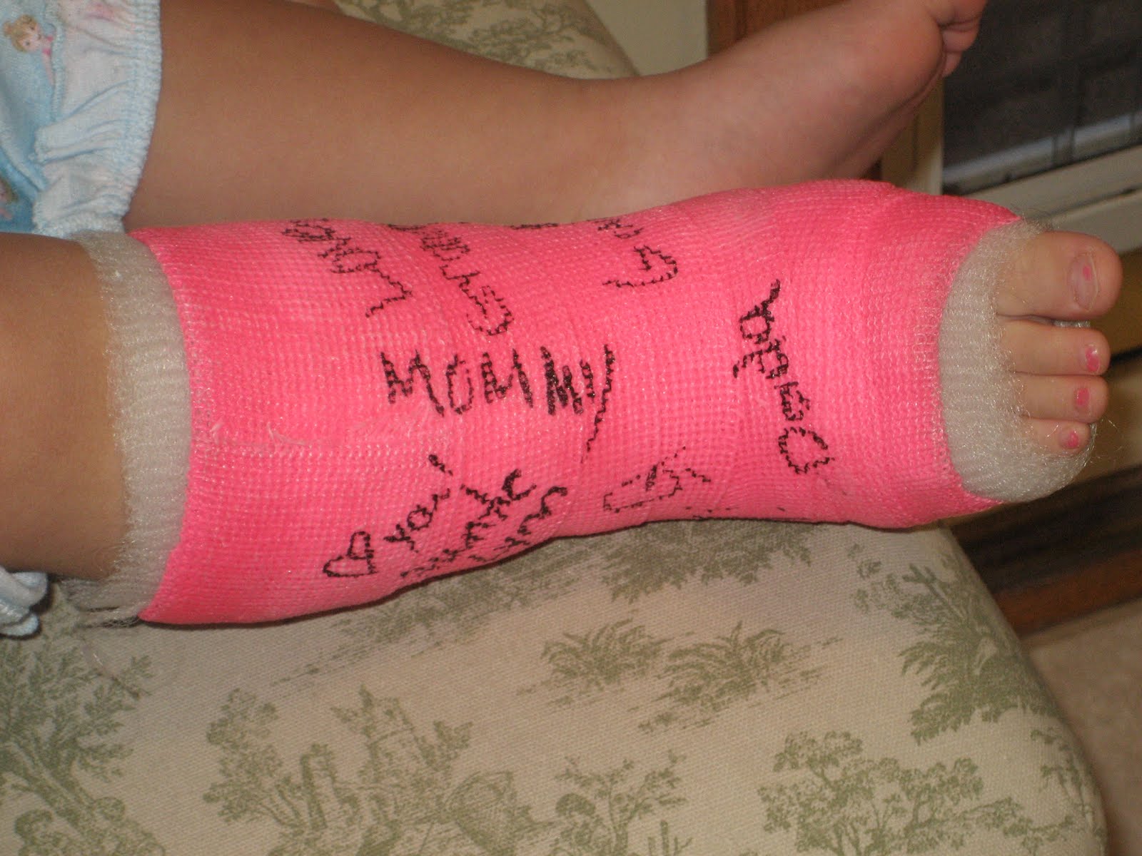 Journey to Our Baby Girl!!!: &ldquo;Bye Bye, Cast!&rdquo;