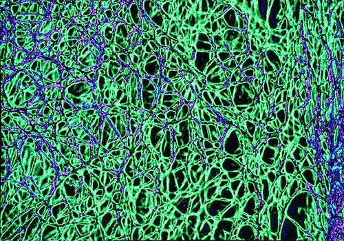 [micrograph.jpg]