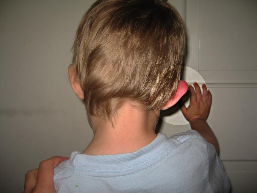 [EAR.JPG]