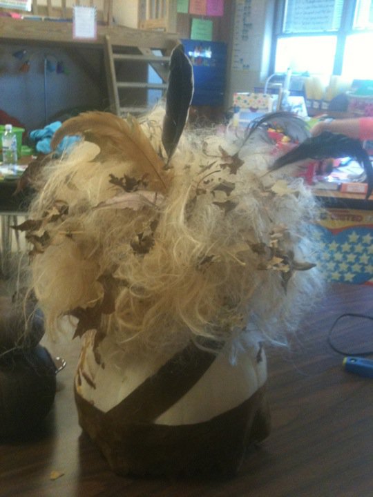 Arm Weakness (unilateral): Overview.