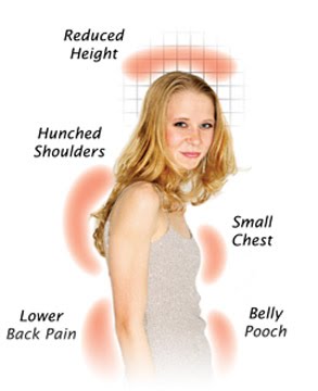 improve posture