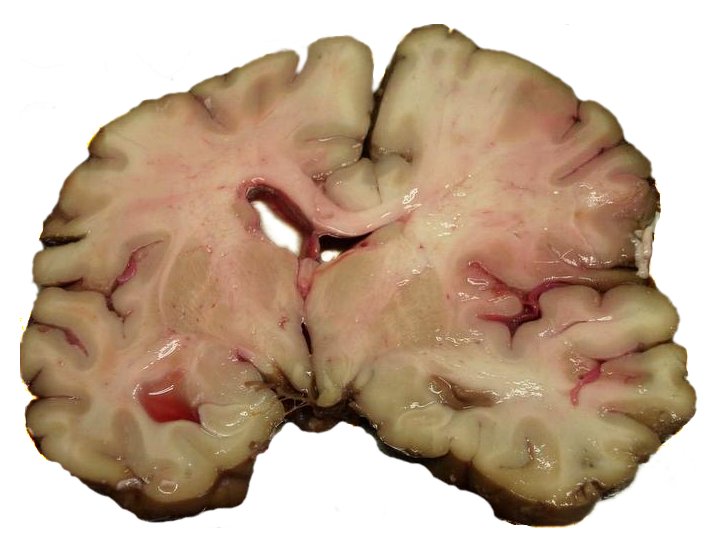 [brain]
