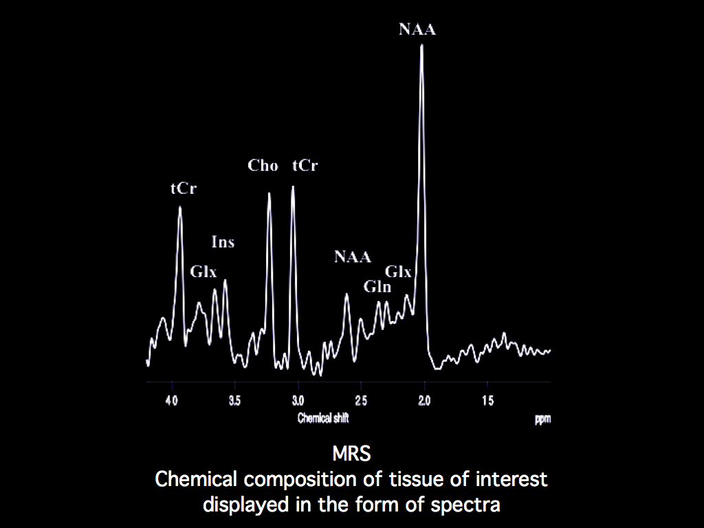 Normal Brain Spectroscopy