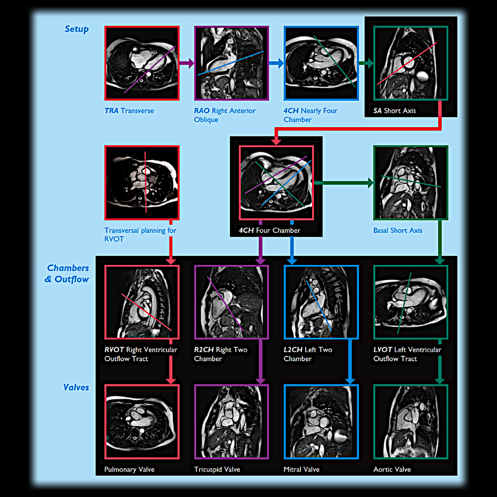 MRI BLOG Cardiac MRI Quick Guide to Imaging planes