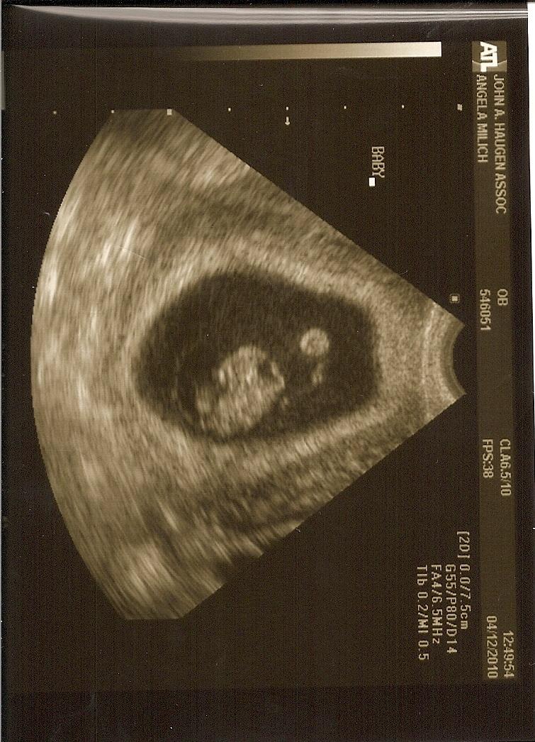 8 Weeks Pregnant Get Ready For The Baby At 8 Weeks Ultrasound Experience - 4voetb6