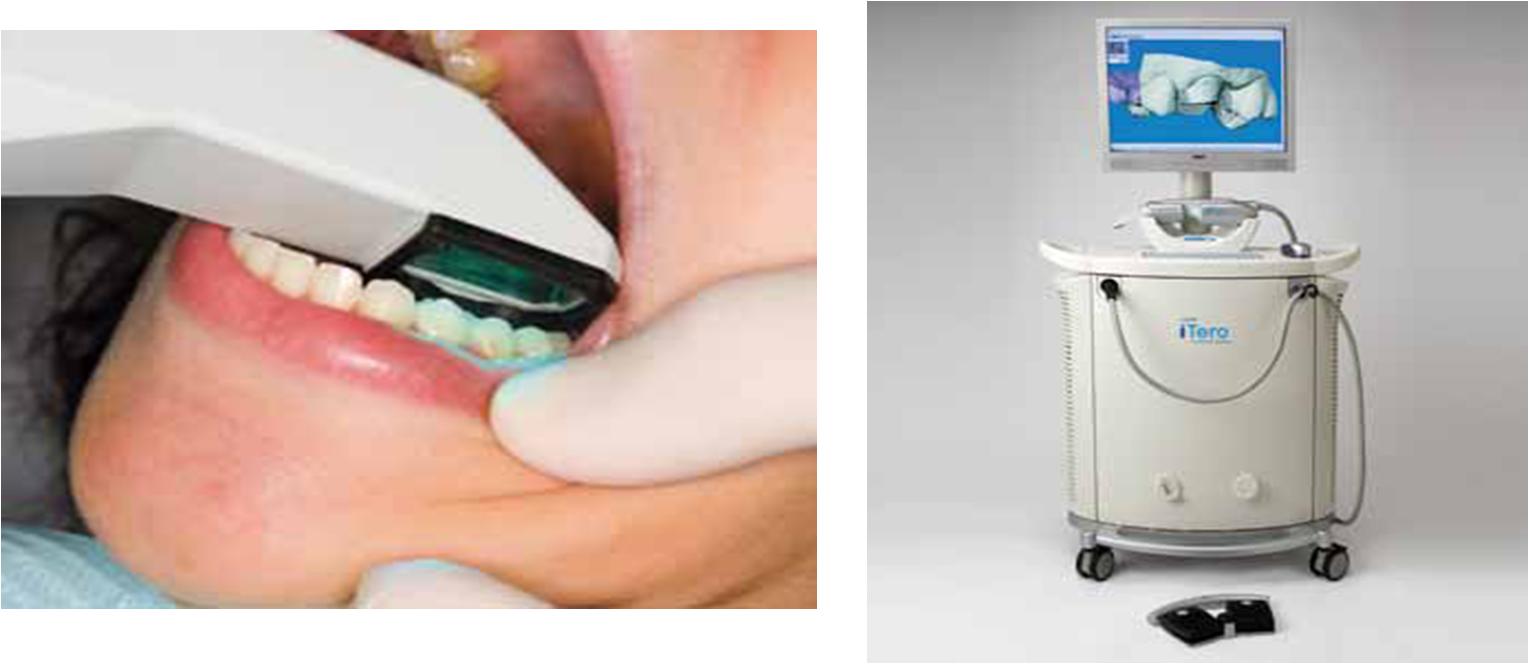 ORTODONTIA CONTEMPORÂNEA: Moldagens digitais e manuseio de modelos