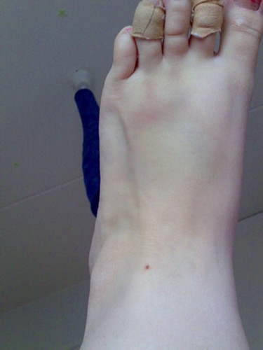 [mustelma_jalassa.jpg]