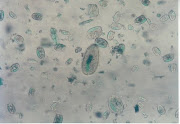 Protozoa Rumen