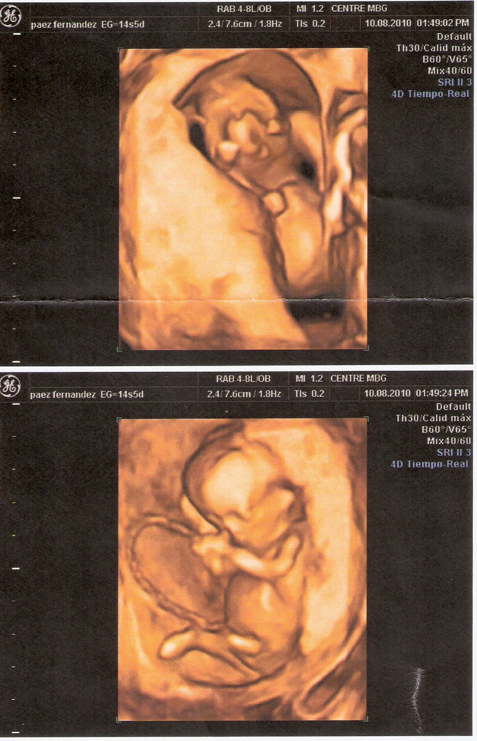 IN BTWIN Las ecografias de mis hermanos/ My brothers ultrasounds