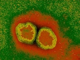 Le virus type A de la grippe