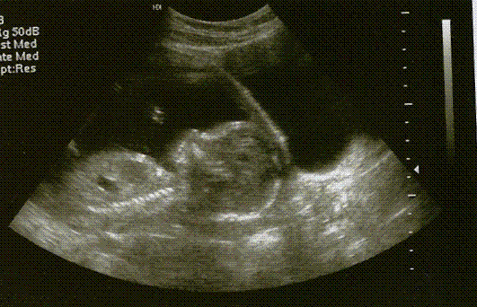[Baby+2.GIF]