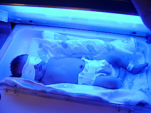 Matthew under the blue bili lights...