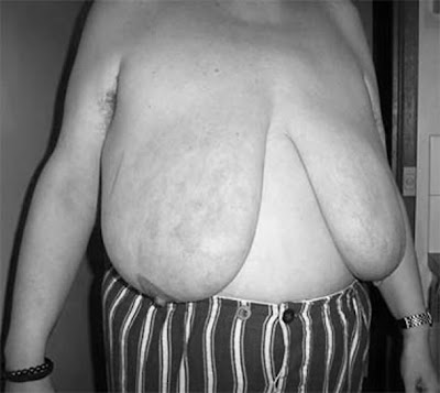 saggy-tits-hairy-pits1a.jpg