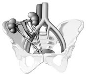 [En_Bloc_Kidney_FINAL.jpg]