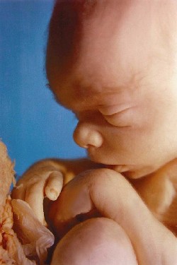 [fig17baby5mos.jpg]