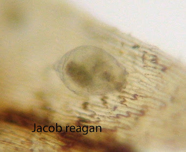 Philodina Rotifer (Russell, Bruce. "Micro Invertebrates" (poster))