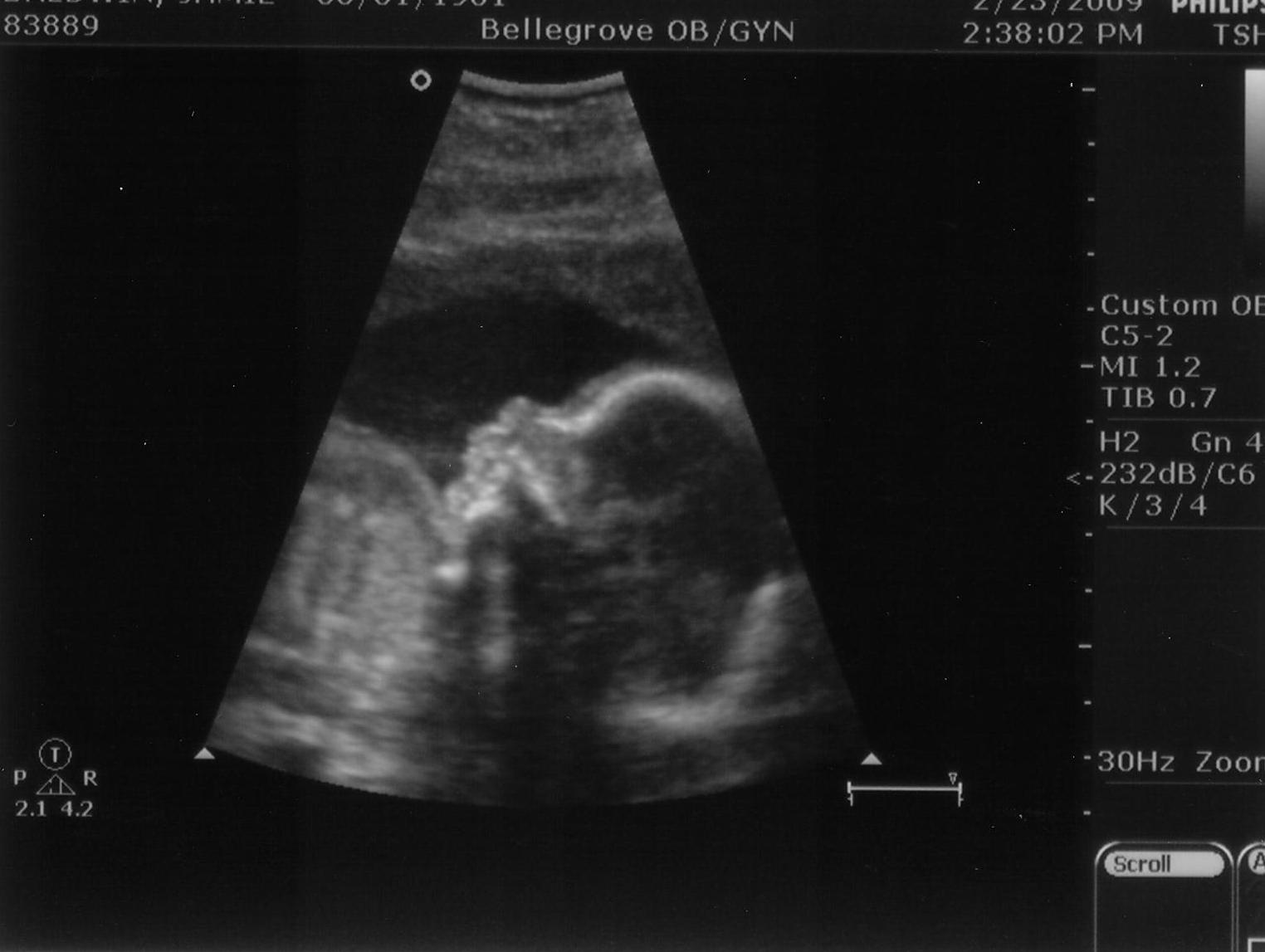 [Ultrasound_5.JPG]