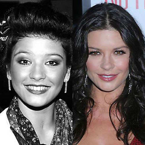 Before And After Plastic Surgery Photos. Celebrities Before And After