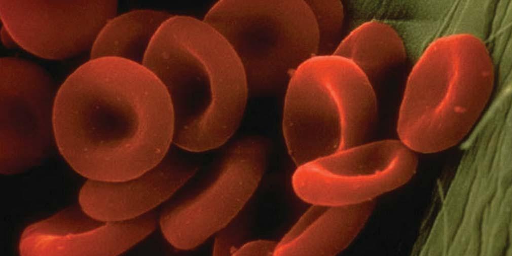 beta thalassemia treatment