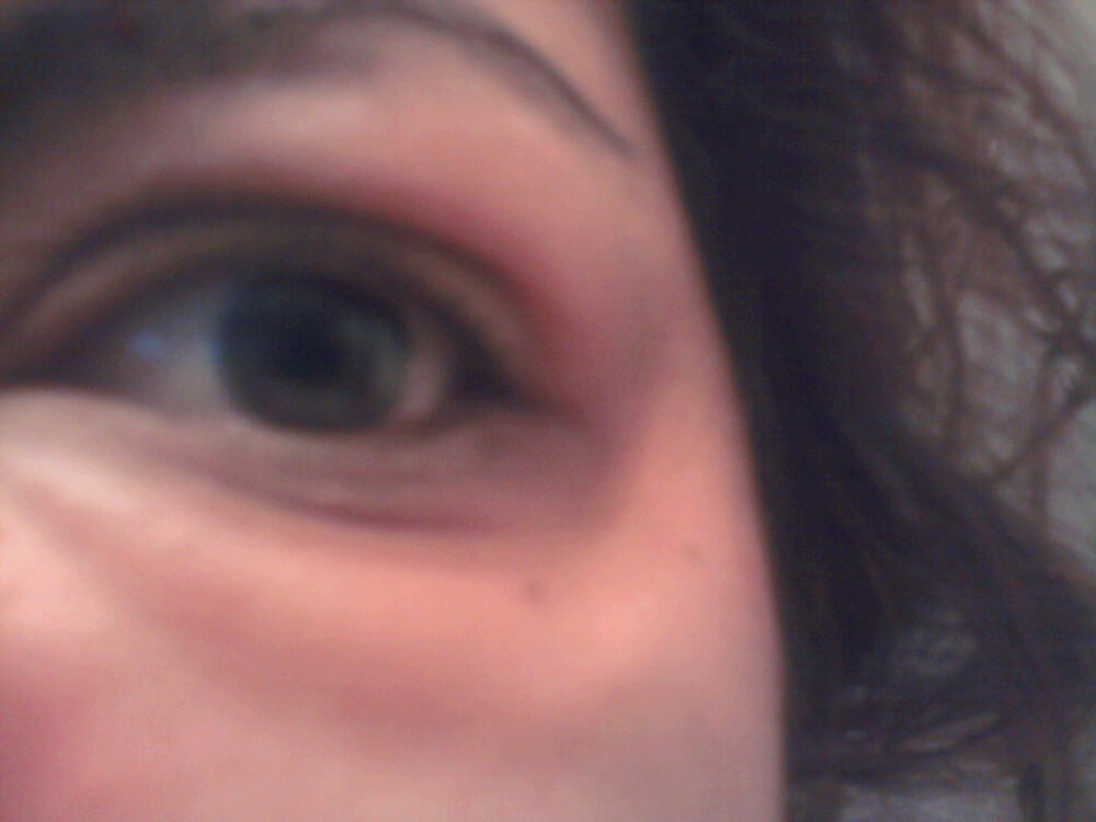 Dairy Allergies Simple.Beautiful.Life.