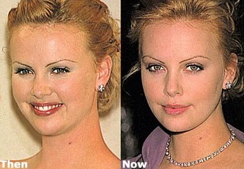 nose job charlize theron surgery plastic face jobs before makeup had happened chin celebrity liposuction bad lipo busy celeb thought