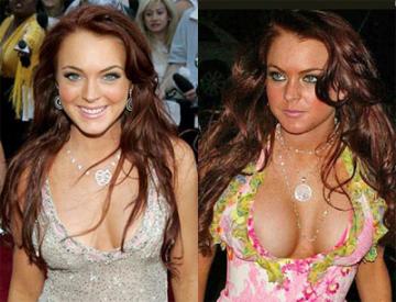 plastic surgery celebrities plastic surgery celebrities