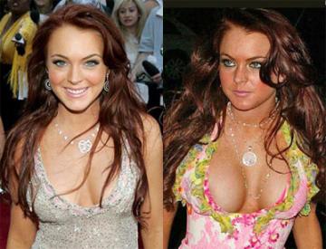 Celebrity Cosmetic Surgery