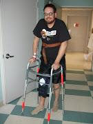 Saga of a Broken Leg (dscf )