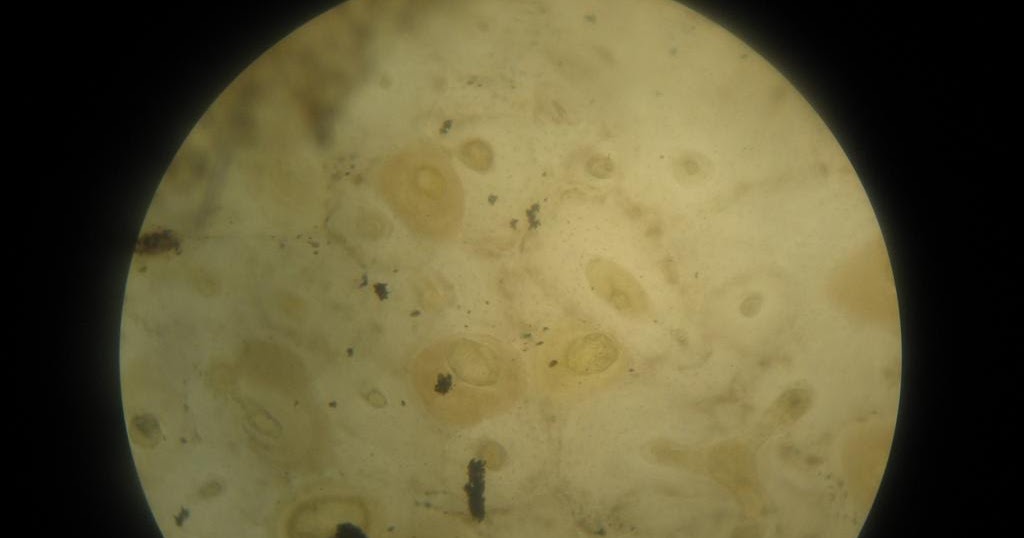 Histology Slides Database Compact Bone Histology Slide