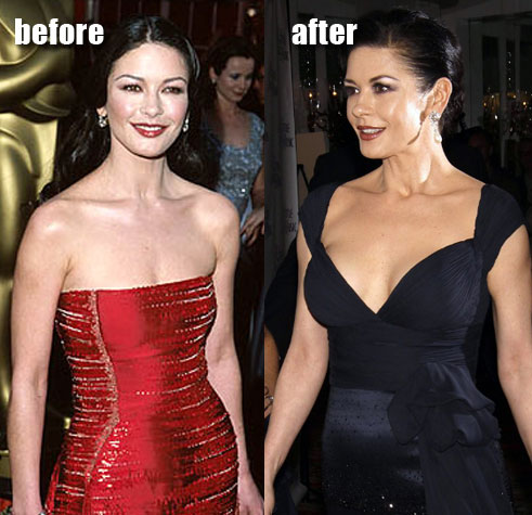 Asian reporter tricia takanawa Chemistry zeta jones boob job