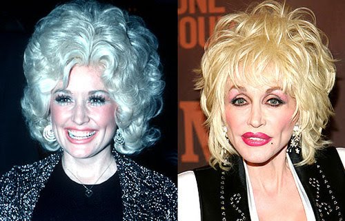 Dolly Parton efore and after