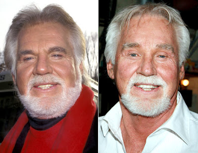 Kenny Rogers Plastic Surgery on Kenny Rogers Plastic Surgery   Cosmetic Plastic Surgery