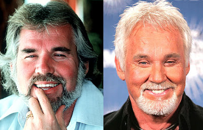 Kenny Rogers Plastic Surgery on Kenny Rogers Plastic Surgery