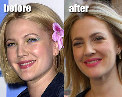  Drew Barrymore  Plastic Surgery on Drew Barrymore Before After Plastic Surgery  Breast Reduction