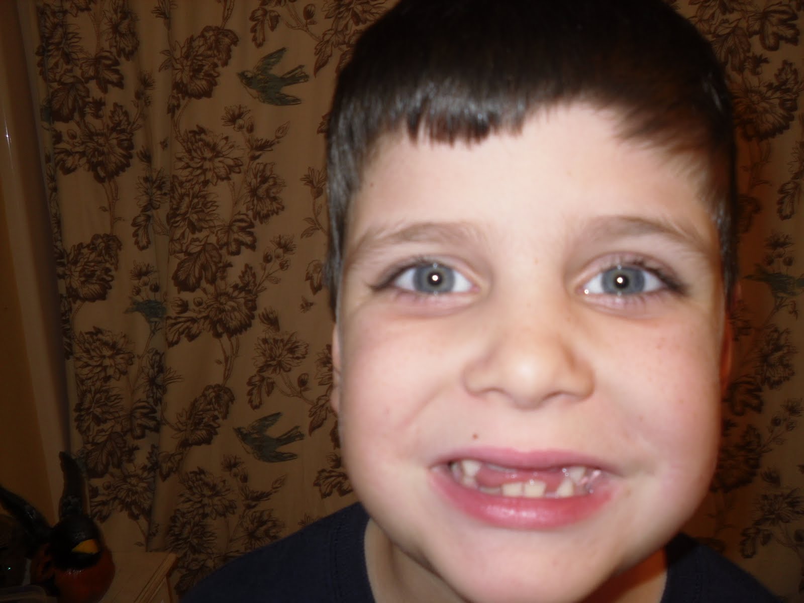 [Colin+without+teeth+001.JPG]