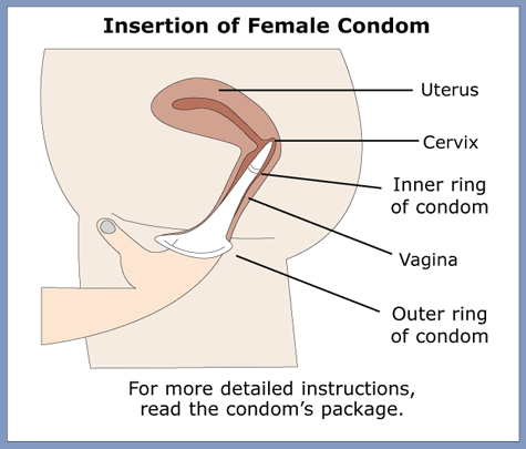 The function of the female condom is pretty much the same as the male condom 