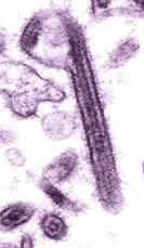 [Ebola+TEM.jpg]