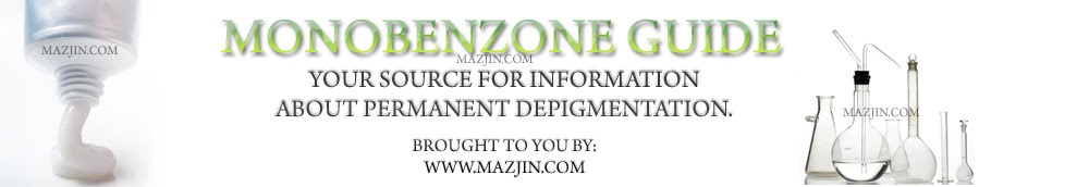 Monobenzone Benoquin Depigmentation Guide