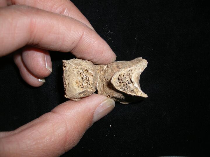 Daily Dose Butterfly vertebra