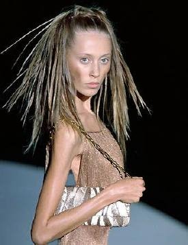 anorexic hair