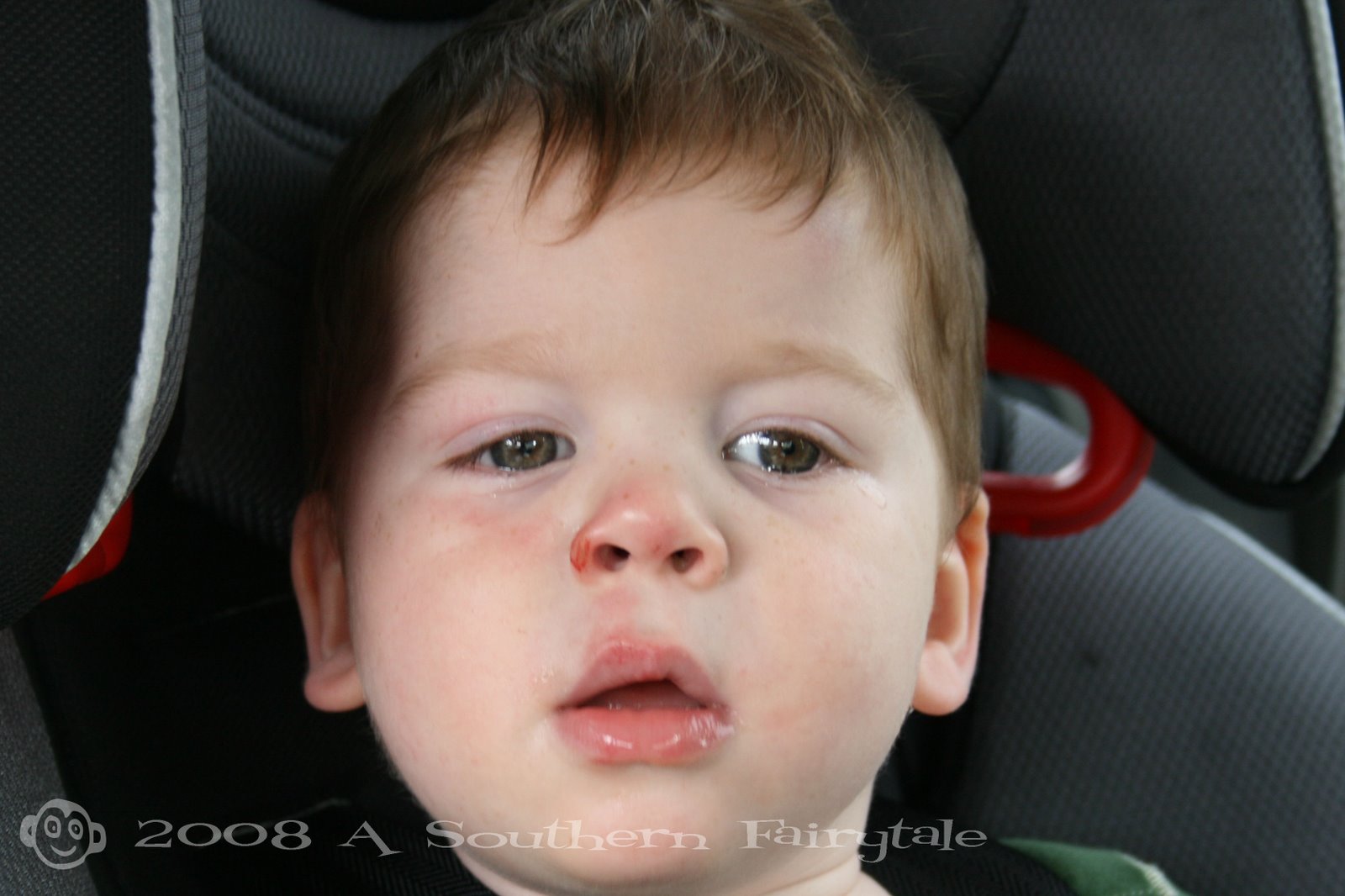 [monkey's+owie+face+for+blog.jpg]