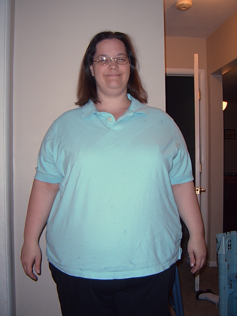 [pre-op+WLS+002.jpg]