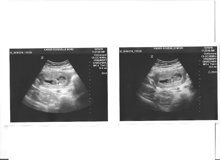 9 weeks pregnant.